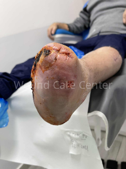 Imagine clinică — etapă a tratamentului