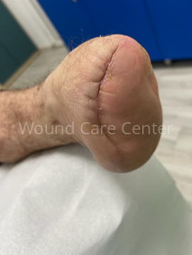 Imagine clinică — etapă a tratamentului
