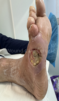 Imagine clinică — etapă a tratamentului