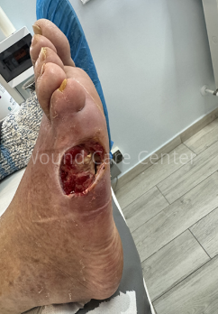 Imagine clinică — etapă a tratamentului