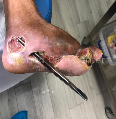 Imagine clinică — etapă a tratamentului