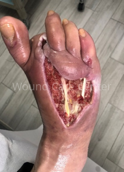 Imagine clinică — etapă a tratamentului