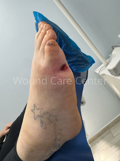 Imagine clinică — etapă a tratamentului