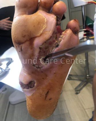 Imagine clinică — etapă a tratamentului