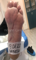 Imagine clinică — etapă a tratamentului