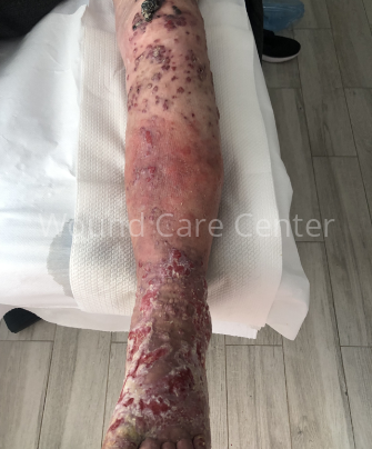 Imagine clinică — etapă a îngrijirii