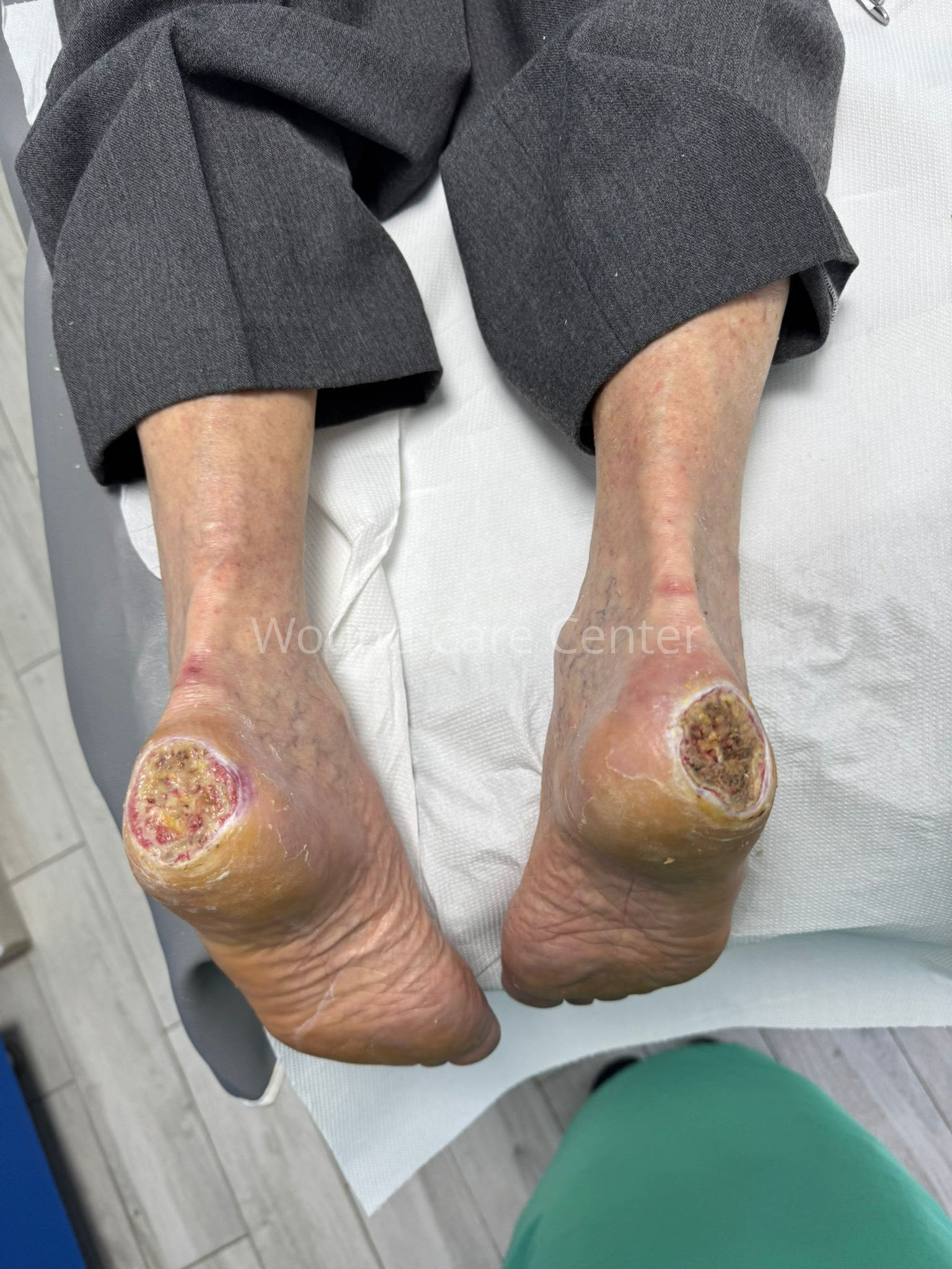 Imagine clinică — etapă a tratamentului