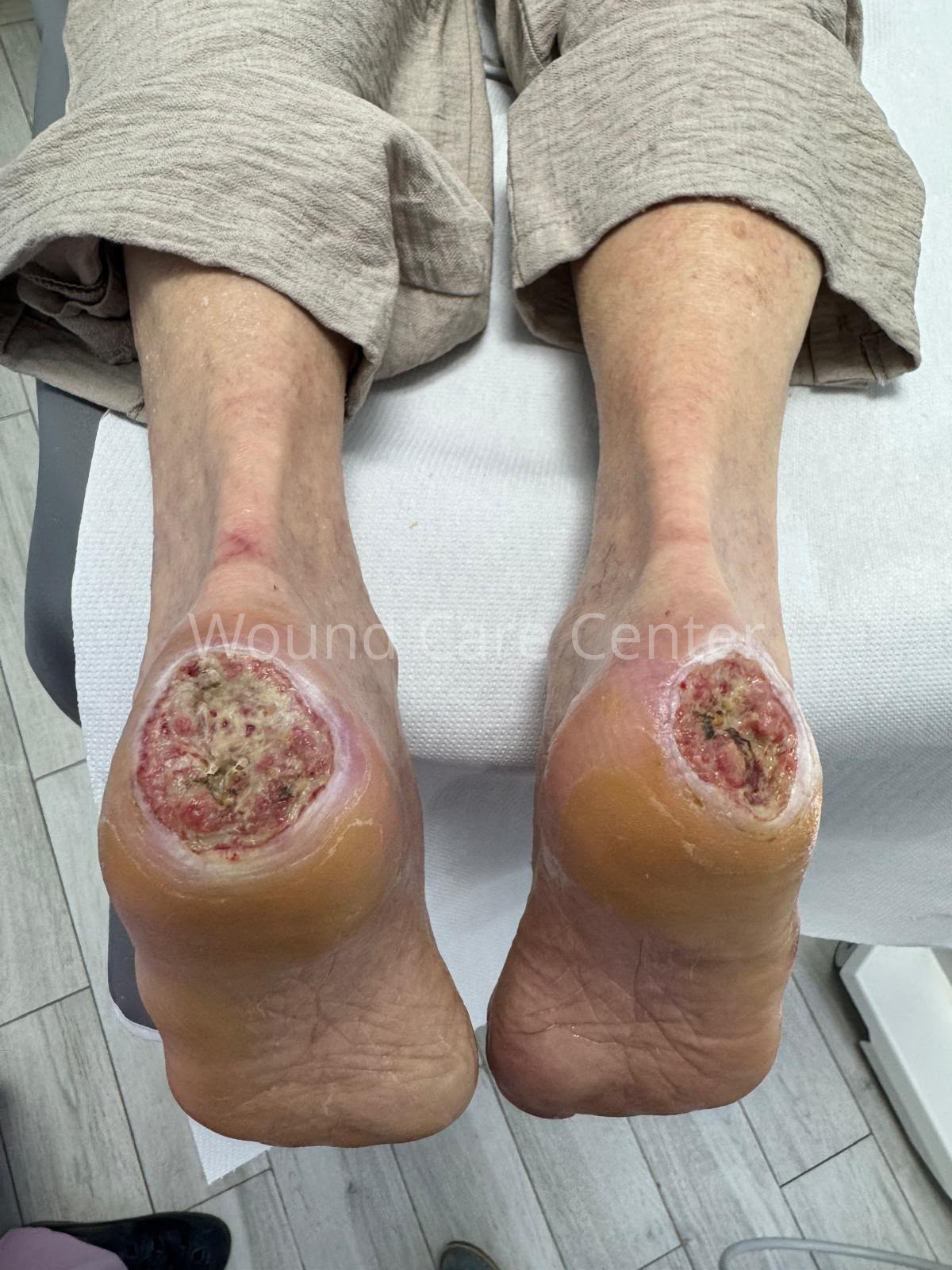 Imagine clinică — etapă a tratamentului