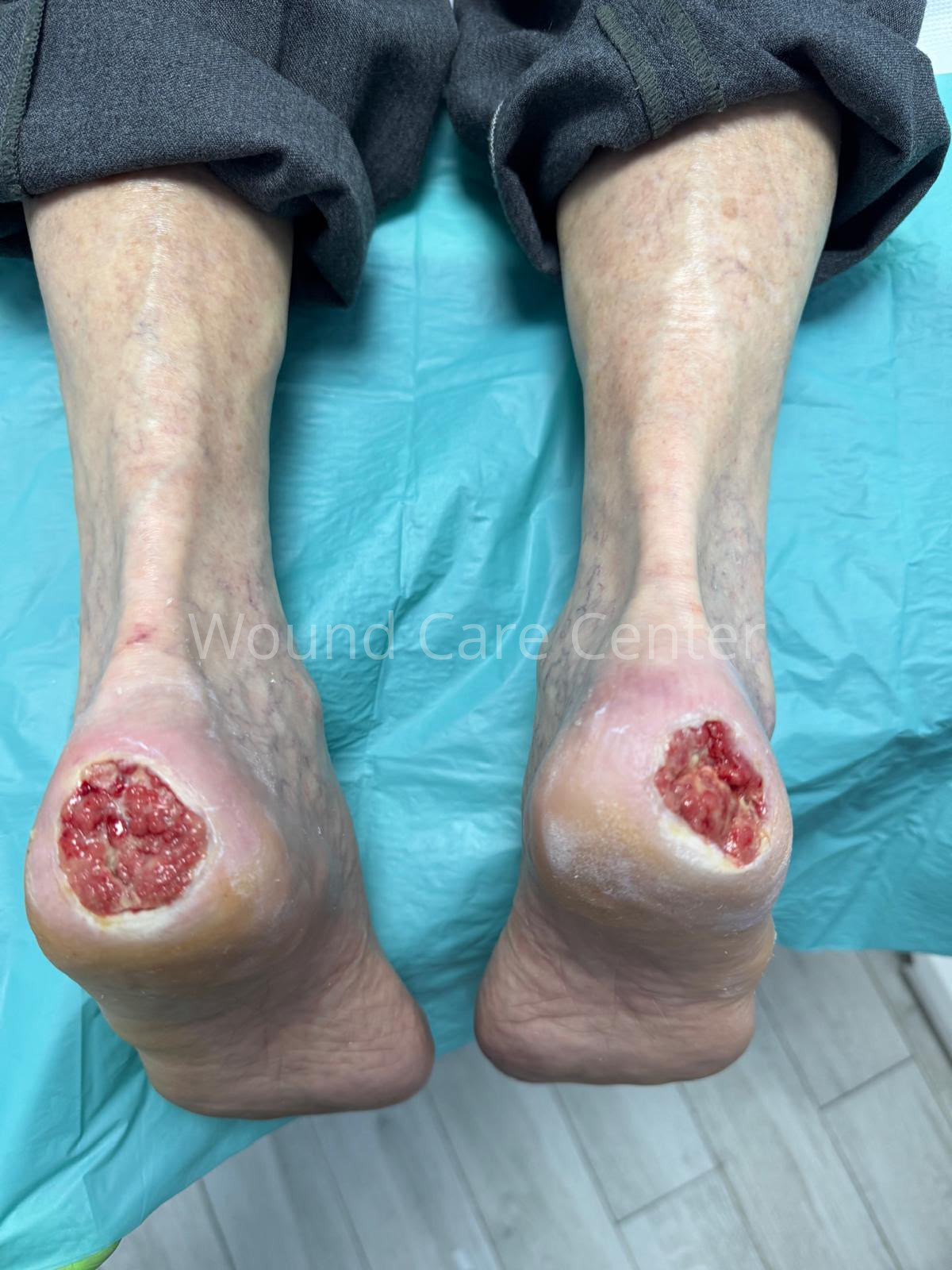 Imagine clinică — etapă a tratamentului