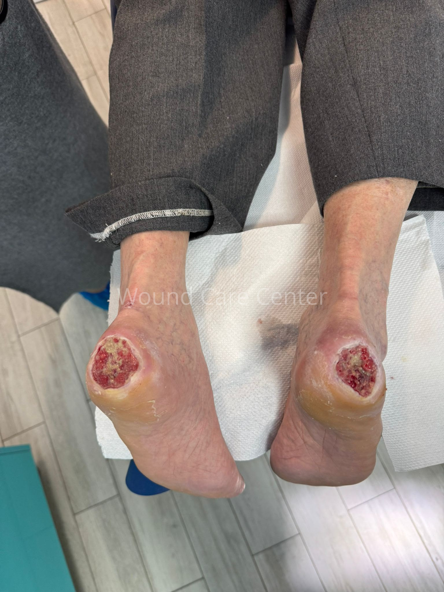 Imagine clinică — etapă a tratamentului