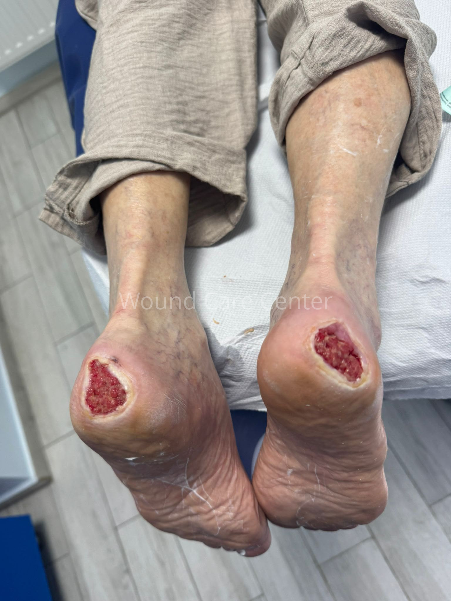 Imagine clinică — etapă a tratamentului
