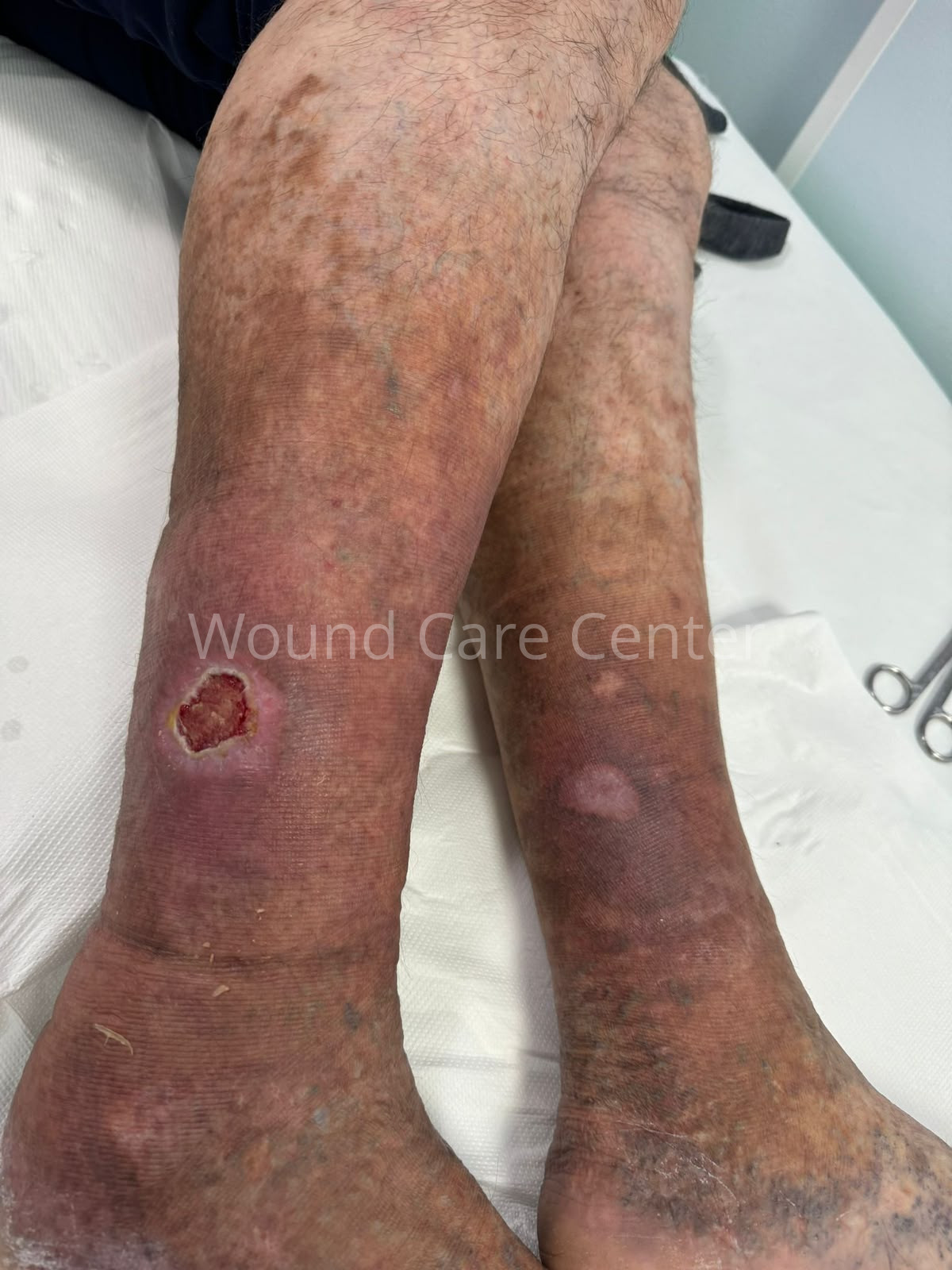 Imagine clinică — etapă a tratamentului